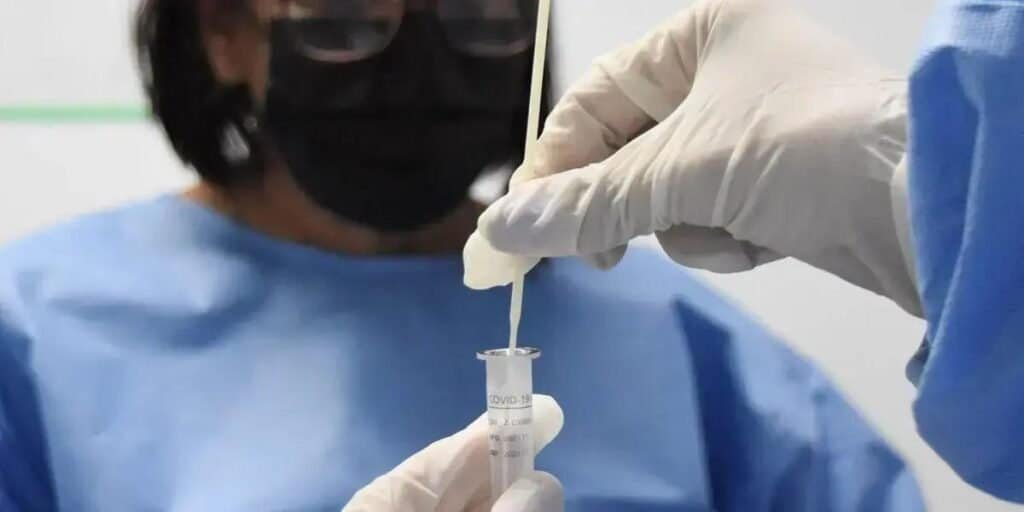 Nova variante XFG da COVID-19 detectada no Rio de Janeiro