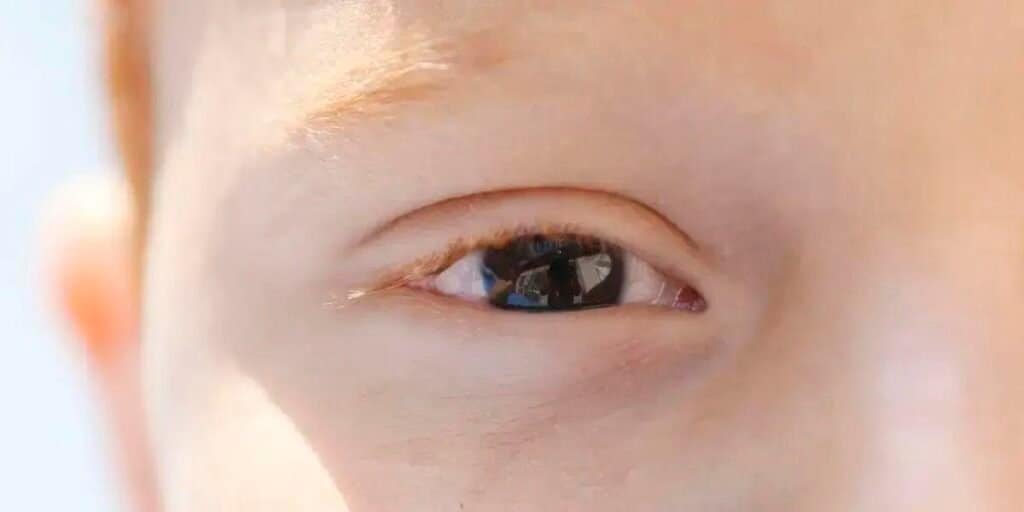 CBO e SBOP lançam cartilha sobre saúde ocular infantil