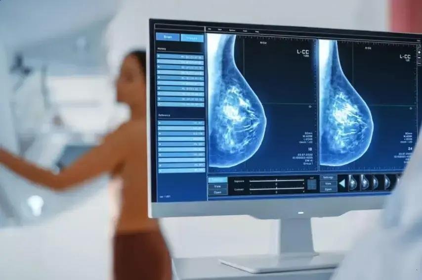 Mamografia agora disponível para mulheres a partir de 40 anos pelo SUS