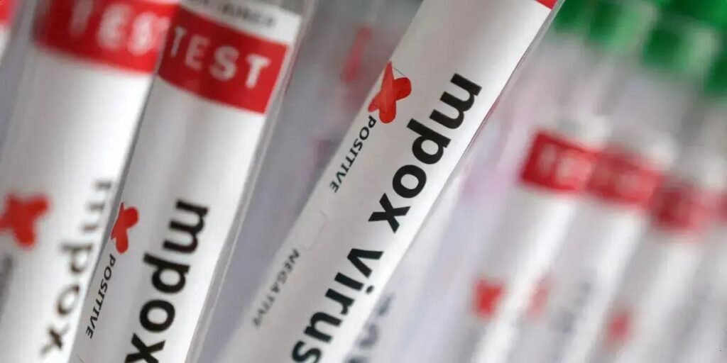 Casos de Mpox no Brasil sobem para 140 em 2026