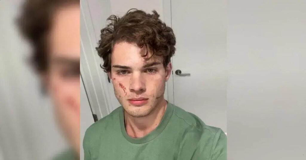 Looksmaxxing: Influenciador Hospitalizado Ap&oacute;s Suspeita de Sobredose