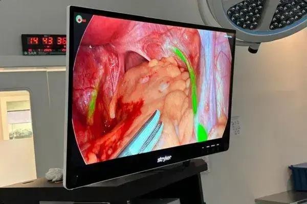 Tacchini adquire Plataforma 1788 com Fluorescência ICG